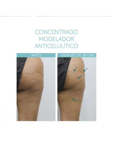 Le concentre de modelage celulite...